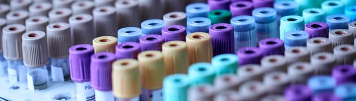 Pandēmijā pasliktinājušies iedzīvotāju analīžu rādītāji: kādas ir ieteicamās veselības pārbaudes laboratorijā un mājas apstākļos?