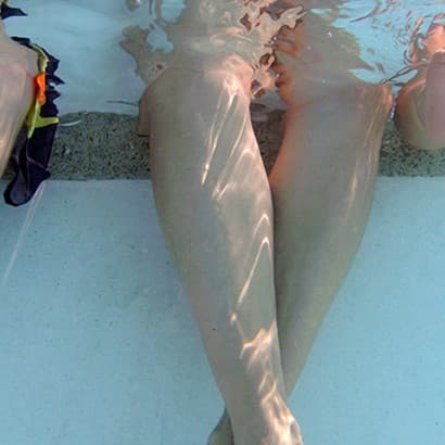 Parūpēsimies par vēnām arī vasarā