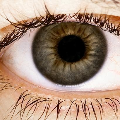 Atpazīsti alerģisku acu iekaisumu