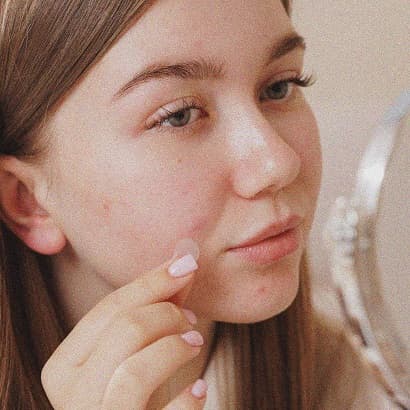 Ādas sēnīte: simptomi, ārstēšana un profilakse