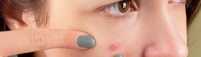 Pusaudžu sejas kopšanas ABC – ar ko sākt un ko ņemt vērā pavasarī