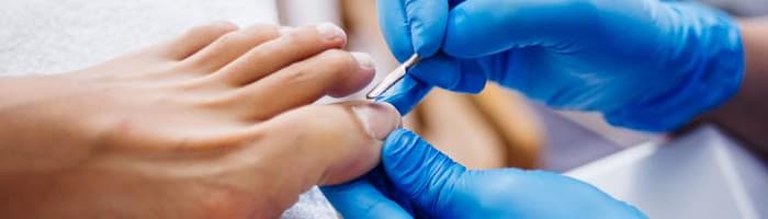 Lai sēnes aug mežā, nevis uz nagiem! 5 padomi, kā novērst sēnītes veidošanos