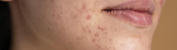 Kā novērst dažādas ādas un labsajūtas problēmas vasarā?