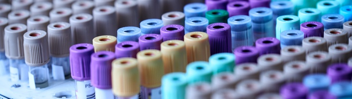 Pandēmijā pasliktinājušies iedzīvotāju analīžu rādītāji: kādas ir ieteicamās veselības pārbaudes laboratorijā un mājas apstākļos?