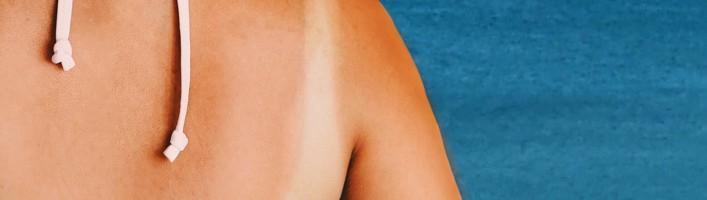 Starp dzīvību un nāvi jeb melanoma