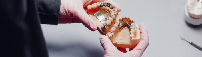Как ухаживать за зубными протезами, чтобы жить без тревог