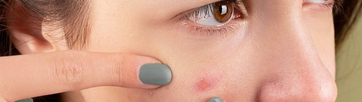 Pusaudžu sejas kopšanas ABC – ar ko sākt un ko ņemt vērā pavasarī