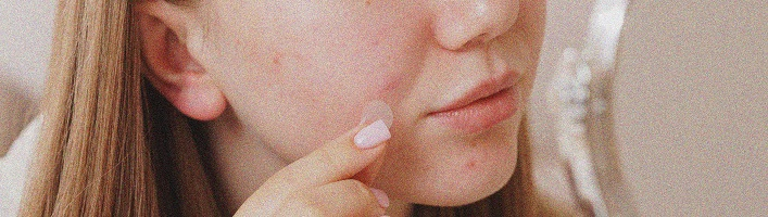 Ādas sēnīte: simptomi, ārstēšana un profilakse