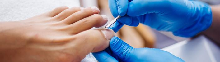 Пусть грибы растут в лесу, а не на ногтях! 5 советов по предотвращению грибка