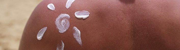 Сметана, уксус и горячий душ: мифы о лечении солнечных ожогов