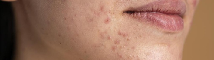 Как летом предотвратить разные проблемы с кожей и самочувствием?