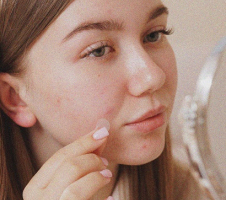 Ādas sēnīte: simptomi, ārstēšana un profilakse