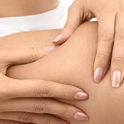 Problēma – celulīts