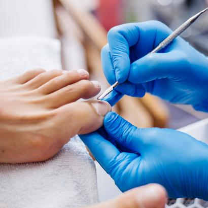 Пусть грибы растут в лесу, а не на ногтях! 5 советов по предотвращению грибка